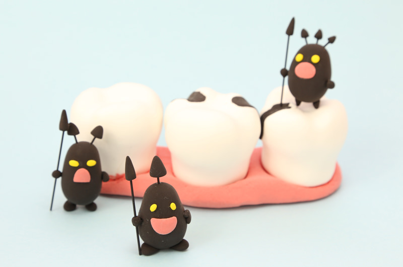 むし歯治療とは