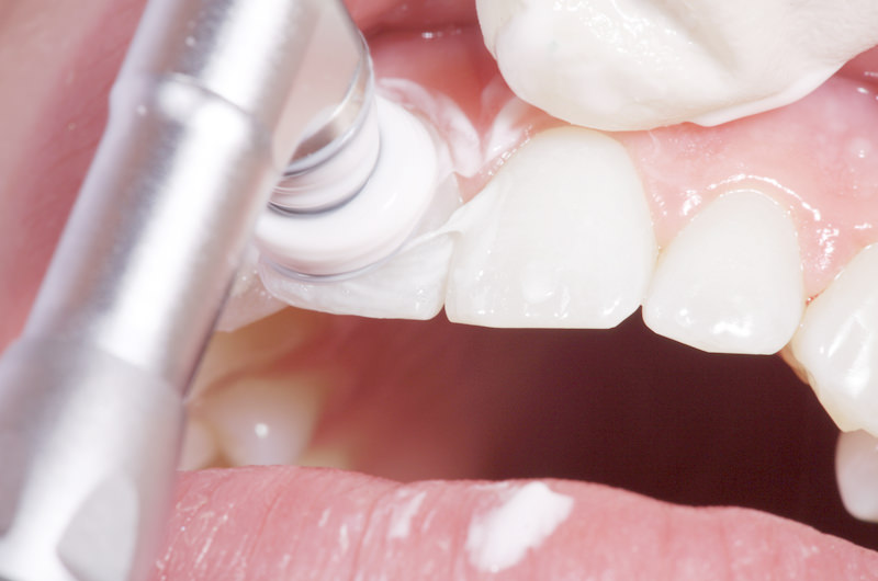 再発を防ぐメンテナンス方法