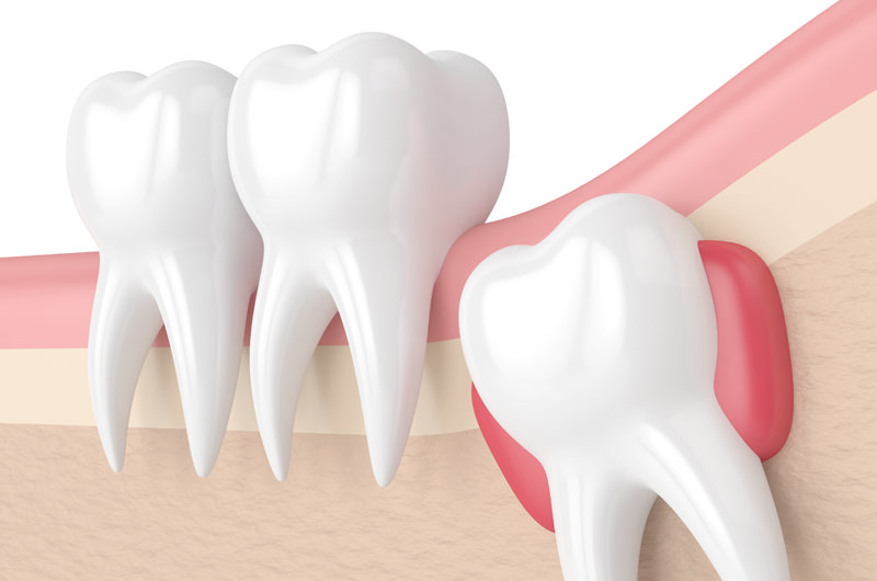 小児矯正の目的とは