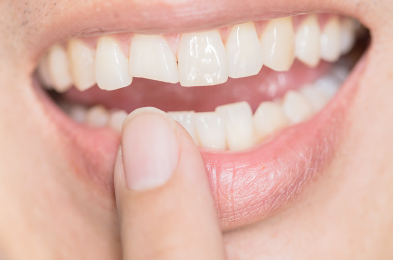 外傷やケガの対応