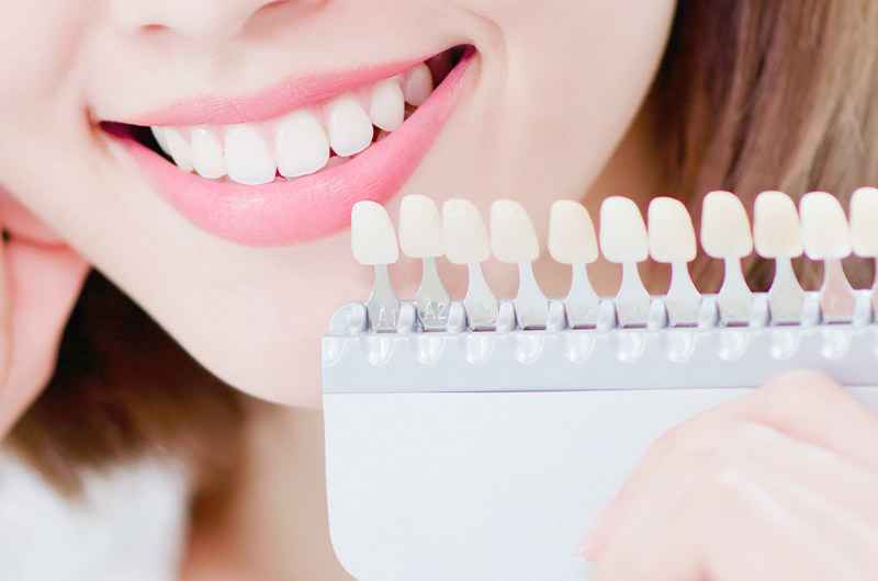 ホームホワイトニング